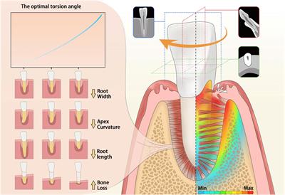 Clinical insights into tooth extraction via torsion method: a biomechanical analysis of the tooth-periodontal ligament complex